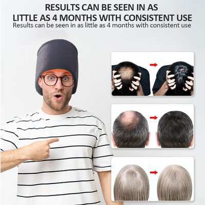 Casque de croissance capillaire 660nm à LED, luminothérapie par lumière rouge et 270 LED, lumière rouge et casque de thérapie laser